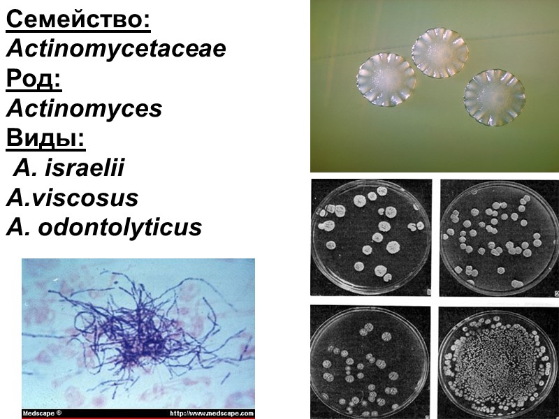 Семейство: Actinomycetaceae Род:  Actinomyces Виды:  A. israelii viscosus A. odontolyticus